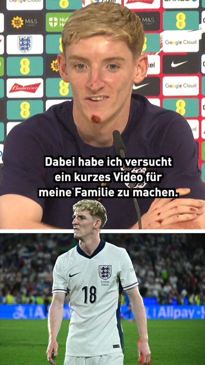 Erholungstour: Englischer Stürmer Gordon fällt vom Rad