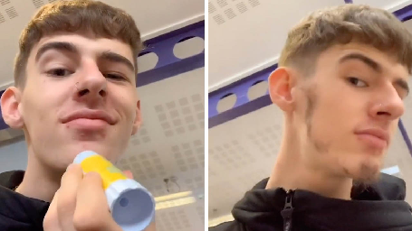 TEEN GLUES LEG HAIR TO FACE TO TRY AND GIVE HIMSELF BETTER BEARD