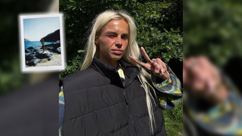 Ex-Bayern-Spielerfrau postet Nacktfoto nach Trennungsgerüchten