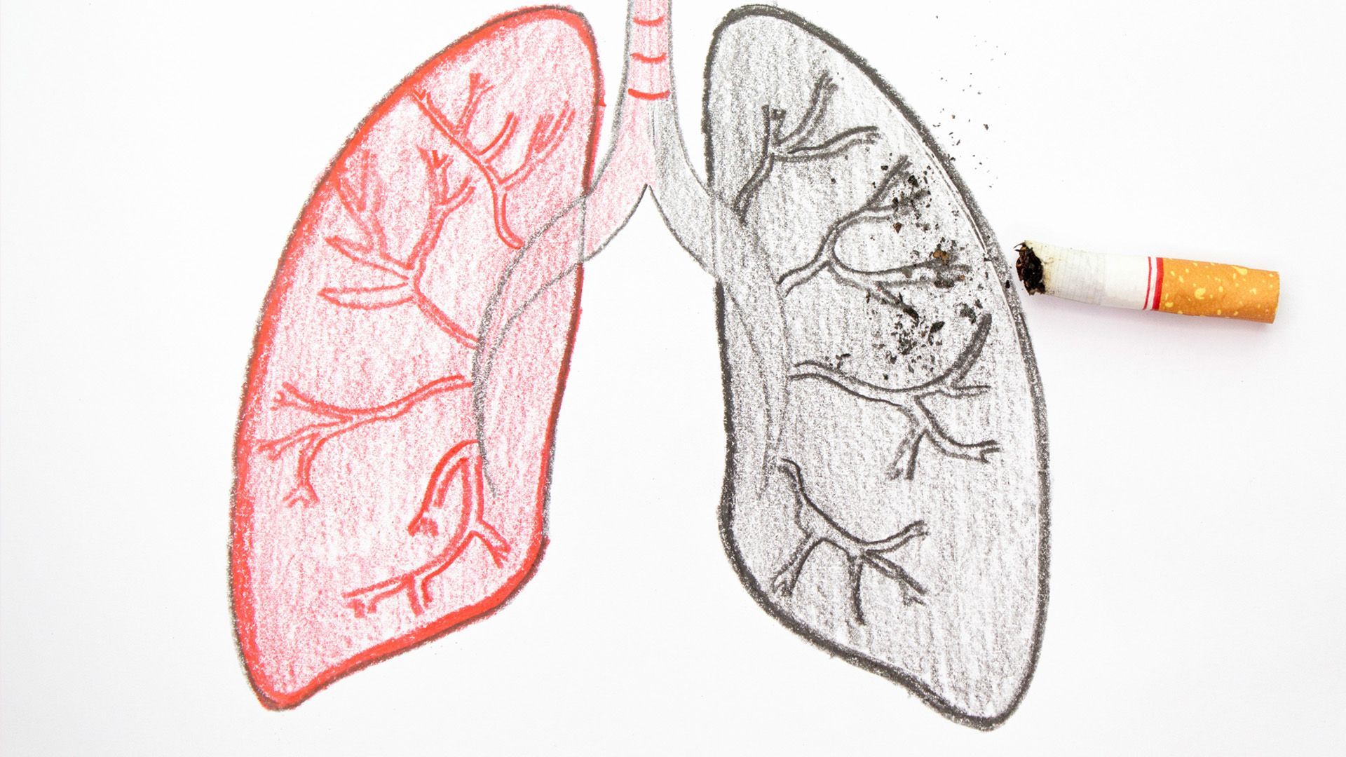 COPD-Symptome: Daran erkennt man die Lungenkrankheit