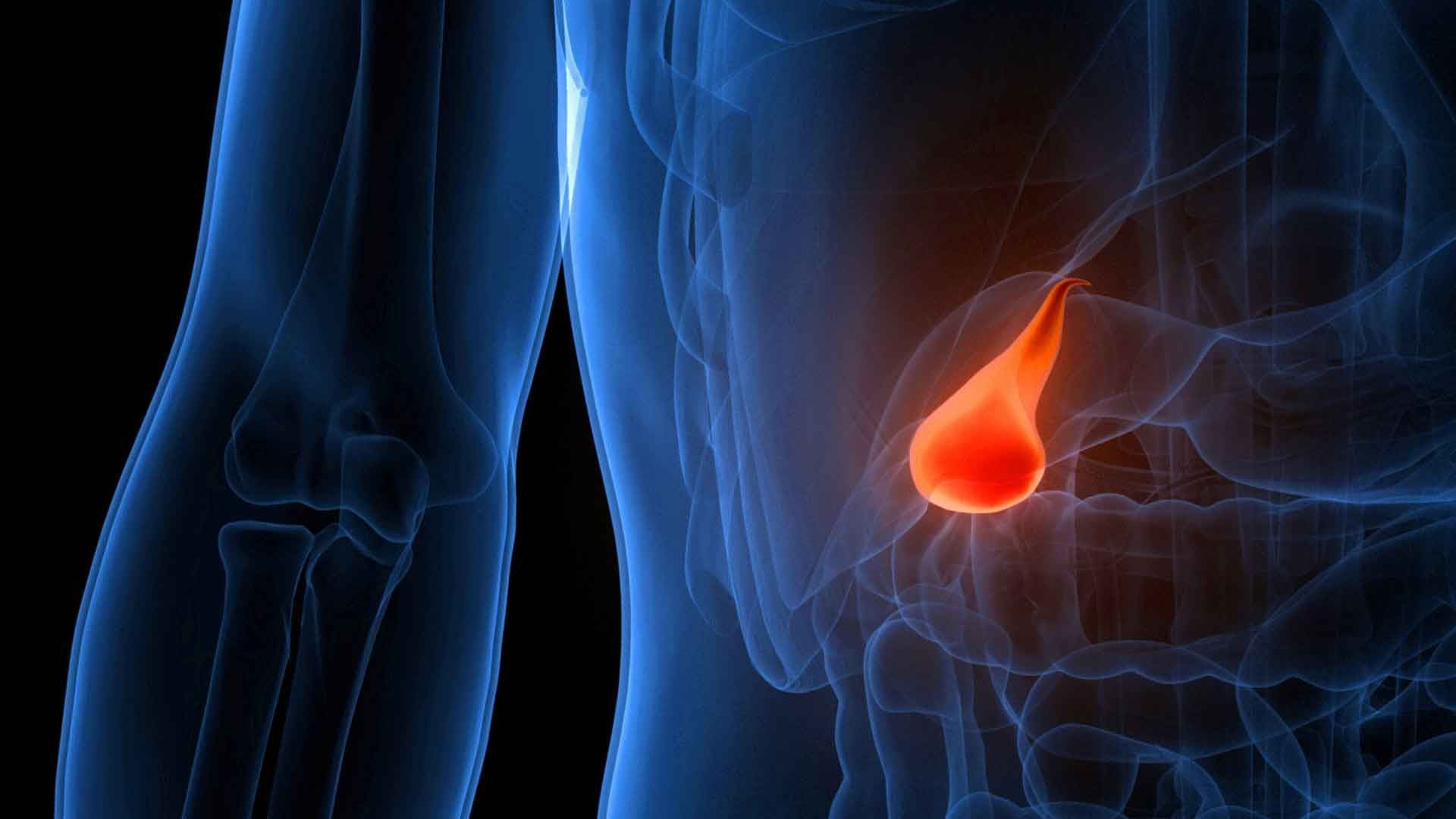 Gallstones: These warning signs you must not ignore