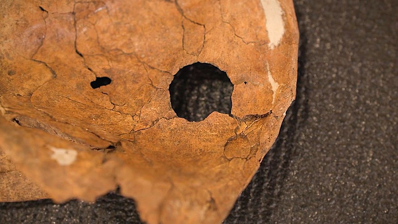 The 75,000-year-old cold case: Scientists find spear hole in Neanderthal bone