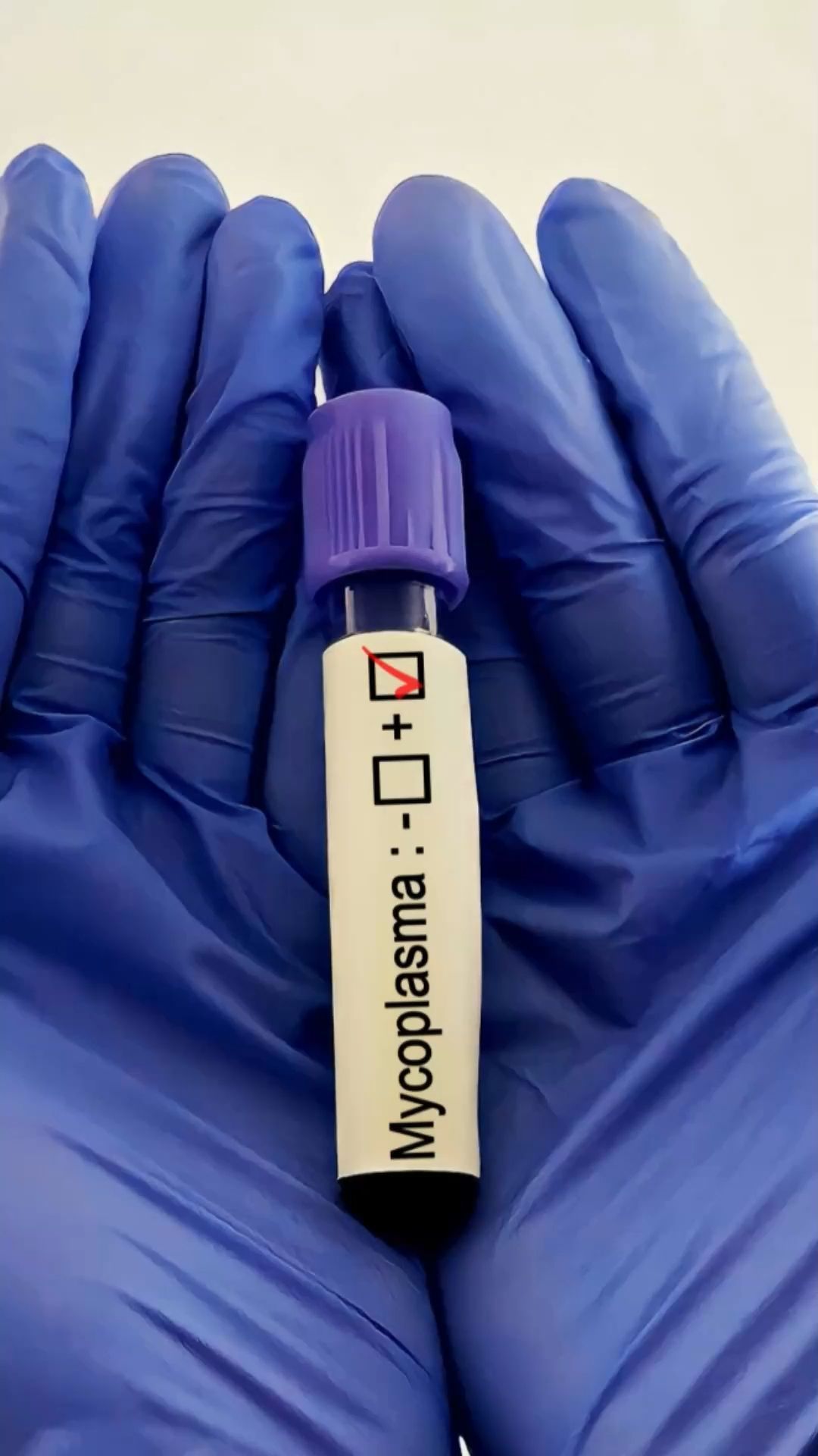 Mycoplasma Infection: Contagion, Symptoms, Treatment, Prevention