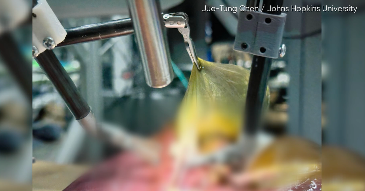 Neuer KI-Roboter operiert ohne menschliche Hilfe