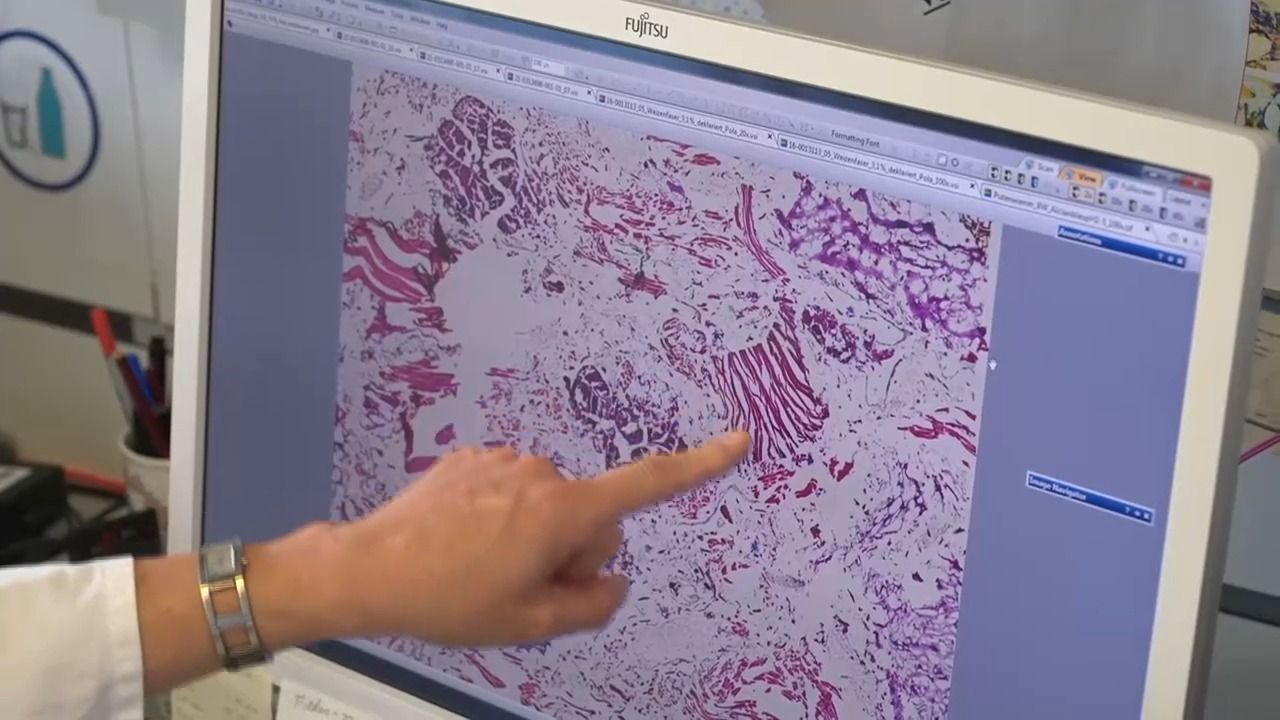 Video: Lebensmittel im Check: Was ist nach Ablauf noch essbar?