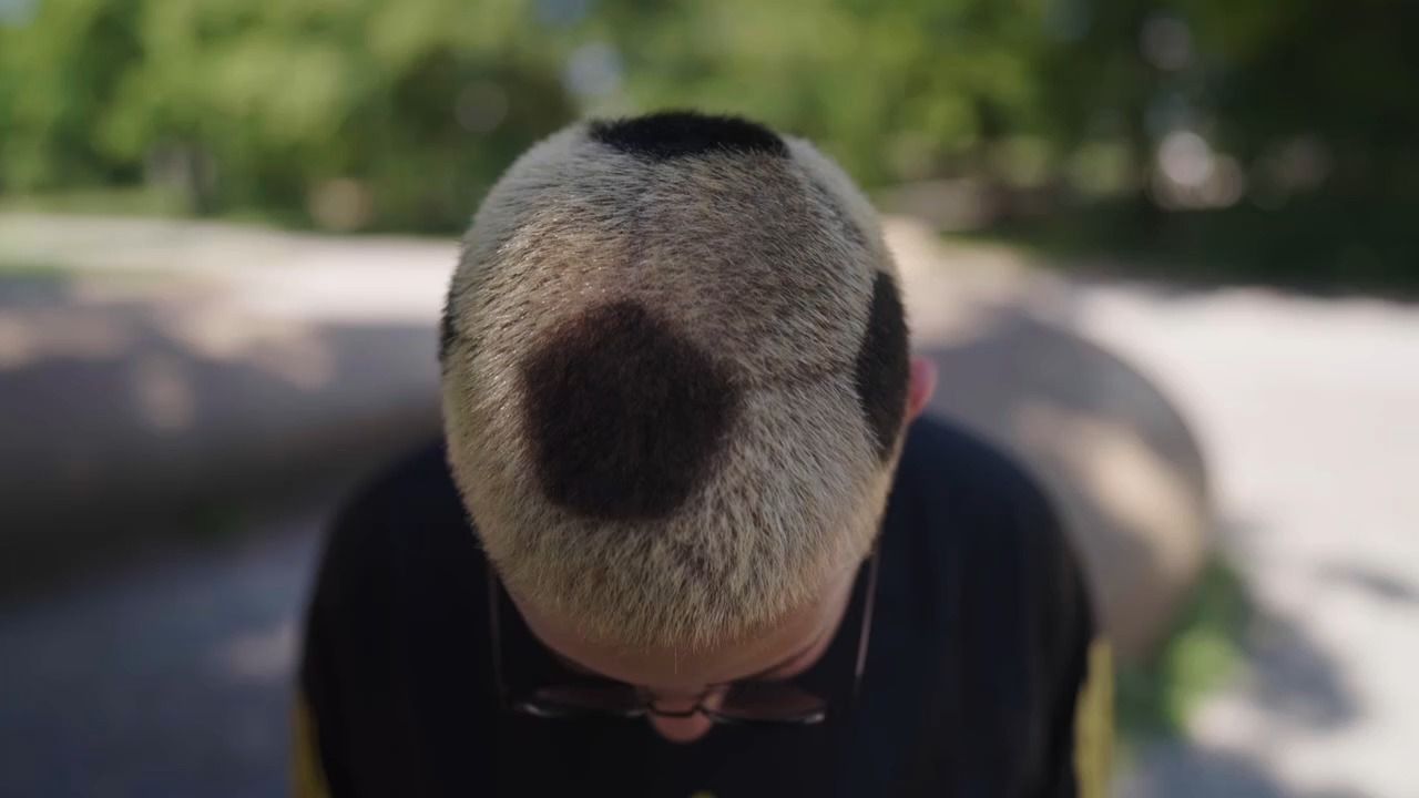 WM-Fieber-mit-Herz-Unterfr-nkin-Marie-spendet-Haare-f-r-Krebshilfe